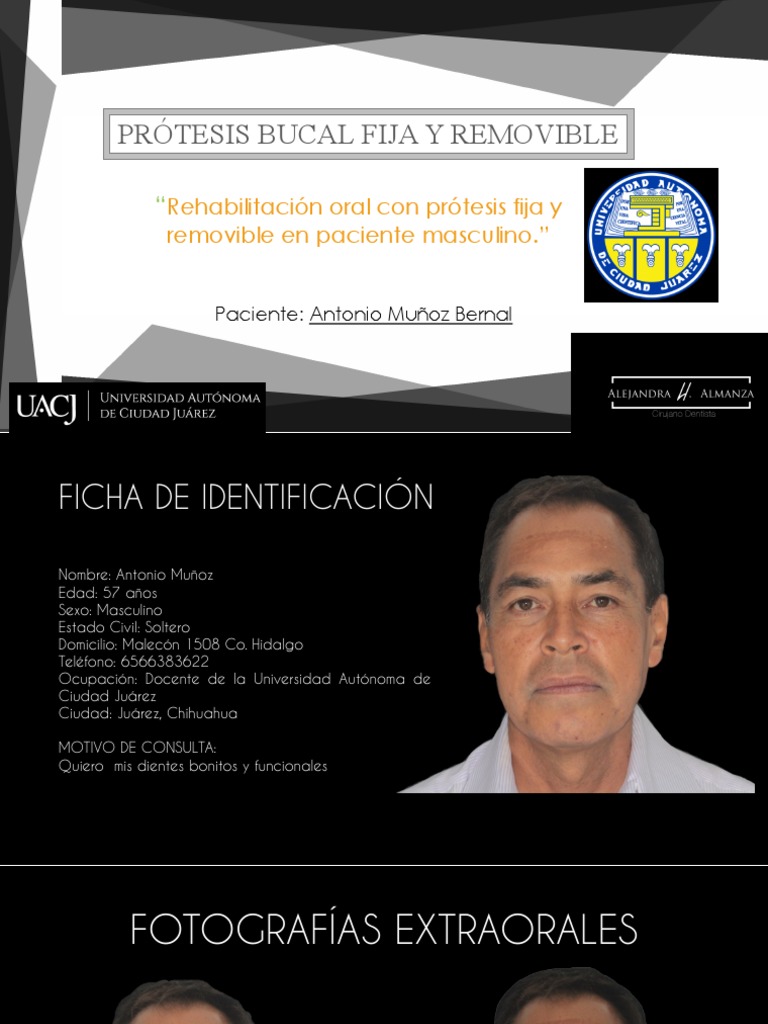 Antonio munoz 11 pdf dentadura postiza odontolog a