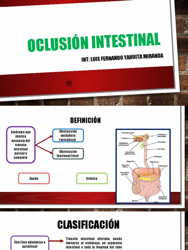 Oclusión Intestinal | PDF | Enfermedades digestivas | Medicina
