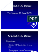 Leads 12 Lead ECG Basics