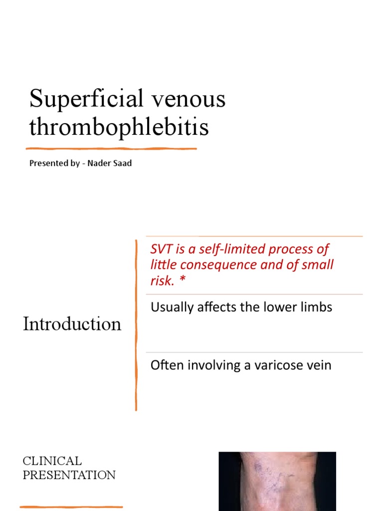 Superficial Venous Thrombophlebitis Presented By Nader Saad Pdf