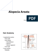 Alopecia Areata