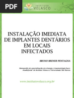 INSTALAÇÃO IMEDIATA DE IMPLANTES DENTÁRIOS EM LOCAIS INFECTADOS