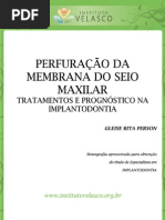 PERFURAÇÃO DA MEMBRANA DO SEIO MAXILAR