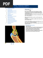 Elbow - Fractures in Children: Fracture Mechanism