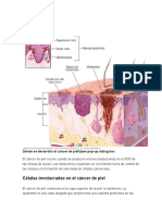 Causas Del Ca de Piel