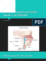 Obstrucción Nasal Del R.N y Del Lactante.