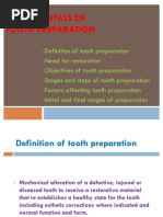 Fundamentals of Tooth Preparation