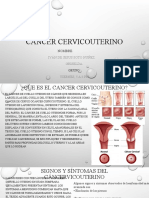 Cáncer Cervicouterino