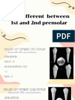 How Different Between 1st and 2nd Premolar