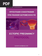 Ectopic Pregnancy RU