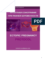 Ectopic Pregnancy RU