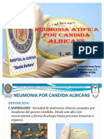 Neumonia X Candida Sesion Clinica