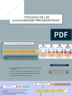 Etiologia de Las Enfermedades Periodontales