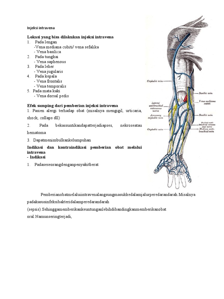 Panduan Injeksi Intravena | PDF | Pengembangan Diri | Kesehatan Holistik