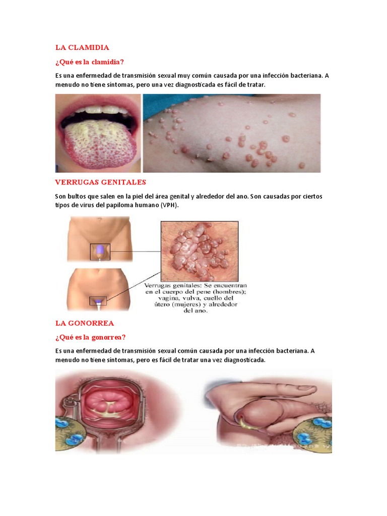 La Clamidia | PDF