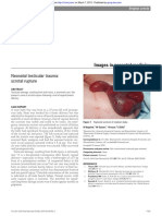 Neonatal Testicular Trauma