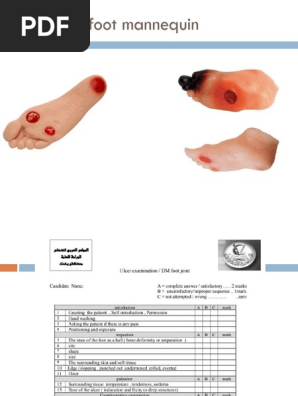 Diabetic Foot 1