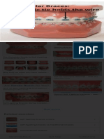 Searchq Self Ligating Braces&rlz 1CDGOYI - enIN987IN987&hl en-GB&sxsrf ALiCzsaddkbp23N5Enhx4g0sVEzI-QpAPg