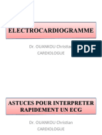 TD ECG L1S1, PDF, Électrocardiographie