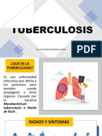 Tuberculosis: Lic. Esthefany Baldeon Loayza