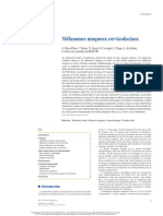 Mélanomes Muqueux Cervicofaciaux