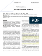 Gallbladder Adenomyomatosis Imaging Findings