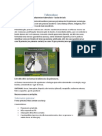 TB: Bacilo de Koch causa tuberculose pulmonar e extrapulmonar