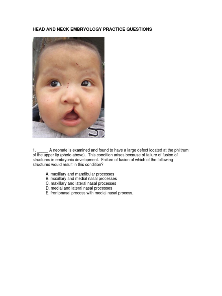 Head and Neck Embryology Quiz Questions | PDF | Human Head And Neck ...