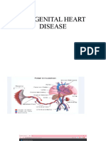 Congenital Heart Disease