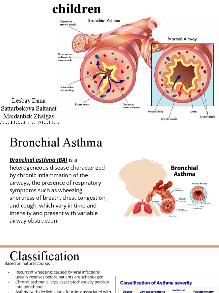 Bronchial Asthma In Children Ppt