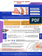 Síndrome Coronario Agudo. Andrea MTZ RMZ