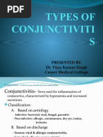 Types of Conjunctivitis