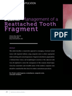 2017 Esthetic Management of A Reattached Tooth Fragment JOURNAL OF COSMETIC DENTISTRY