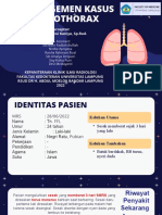 MK Pneumothorax