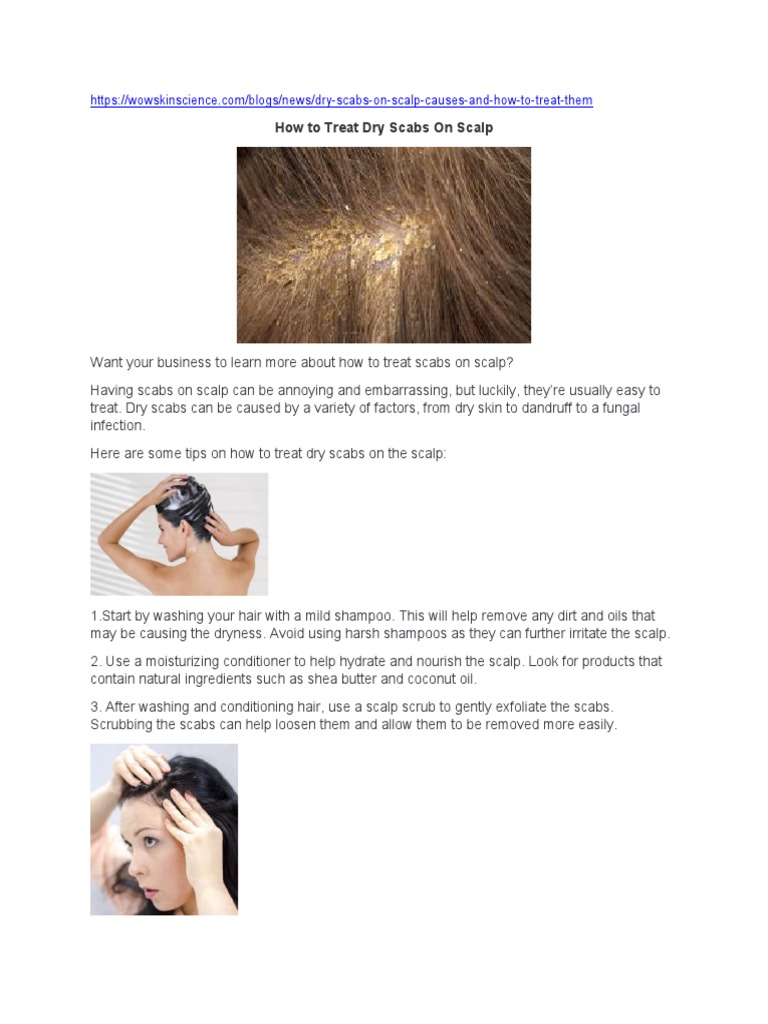 MuhammadHow To Treat Dry Scabs On Scalp PDF