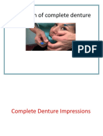 Impression of Complete Denture