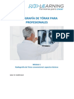 Radiografía de tórax: aspectos básicos para profesionales