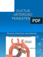 Ductus Arterioso Persistente