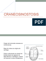 Craneosinostosis