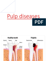 Pulp Diseases - 023412