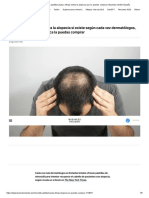 Minoxidil - La Pastilla Barata y Eficaz Contra La Alopecia Que No Puedes Comprar - Business Insider España