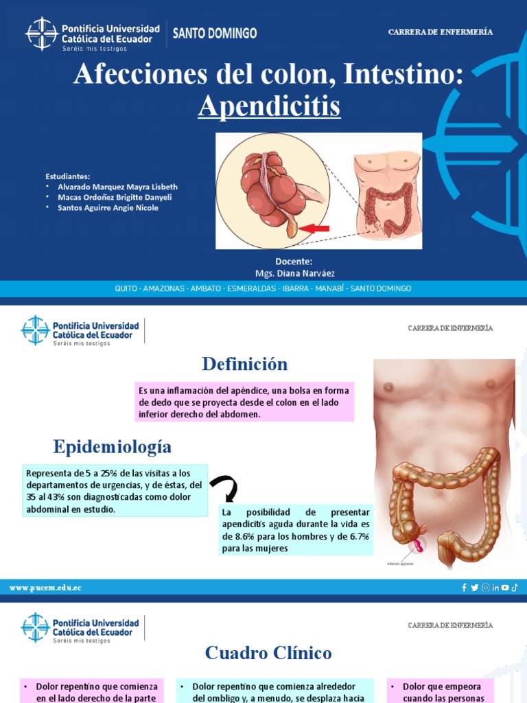 apendicitis-pdf-especialidades-medicas-medicina-clinica