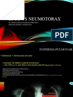 Enfisema Vs Neumotorax