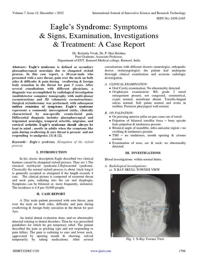 Eagle's Syndrome Symptoms & Signs, Examination, Investigations