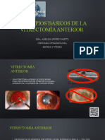 Vitrectomía Anterior