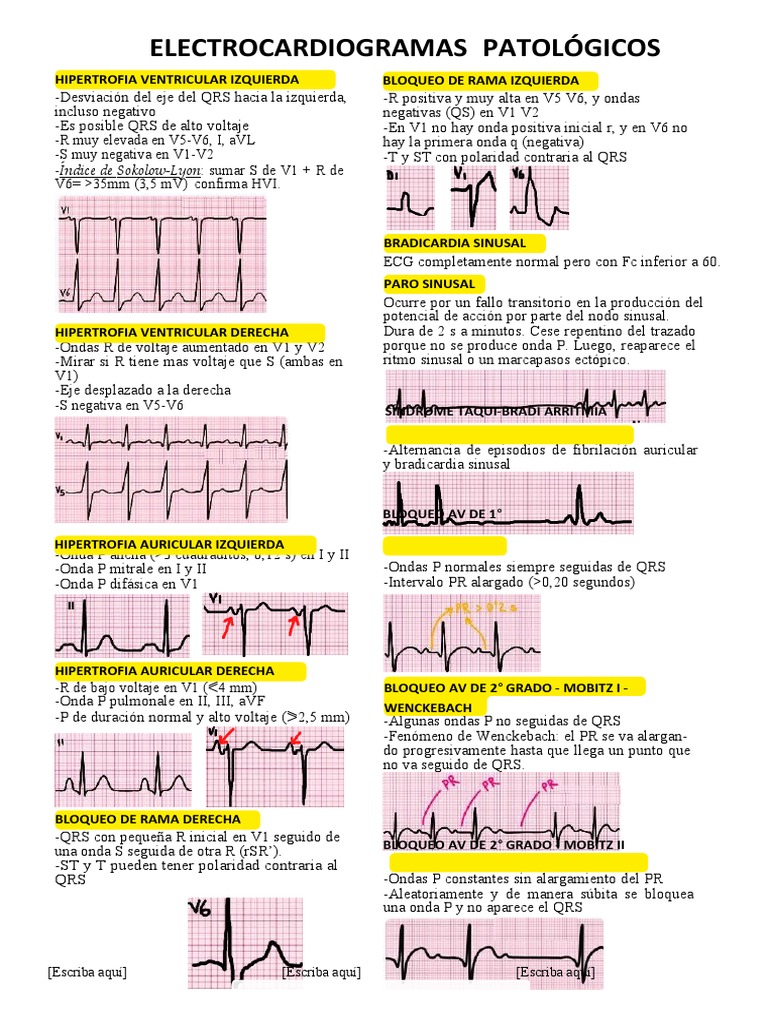 resumen-ecg-patologico-pdf-electrocardiografia-enfermedades-y
