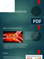 Ateroesclerosis