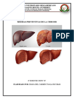 Guion de Cgarla Medidas Preventivas de La Cirrosis