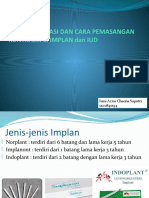 Cara Pemasangan IMPLAN N IUD