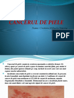 Cancerul de Piele